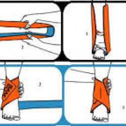 SAM Splint Kırık Sabitleme Ateli 18"